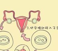 攻略；泰国nic医院三代试管婴儿技术如何？费用如何