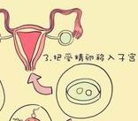 邛崃市不育不孕怎么办？邛崃市治疗不孕不育哪家医院好？