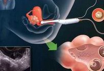 浙江地区有哪些私立的机构可以做试管技术？浙江的试管成本有多高？