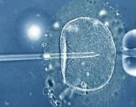 在湖州做一次三代试管婴儿需要多长时间？哪些人适合做三代试管婴儿？